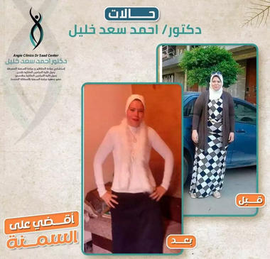 Slider image (3) Dr. Ahmed Saad Khalil
